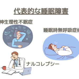 代表的な睡眠障害 精神生理性不眠症 睡眠時無呼吸症候群 ナルコレプシー